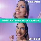 White Now Stain Eraser toothpaste for Teeth Whitening, , small image number null